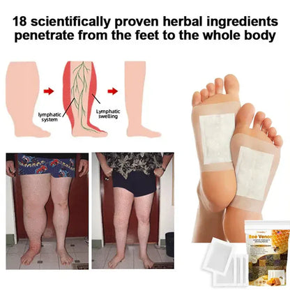 Bee Venom Lymphatic Drainage & Slimming Foot Patches🌿👣 [Pack of 10]